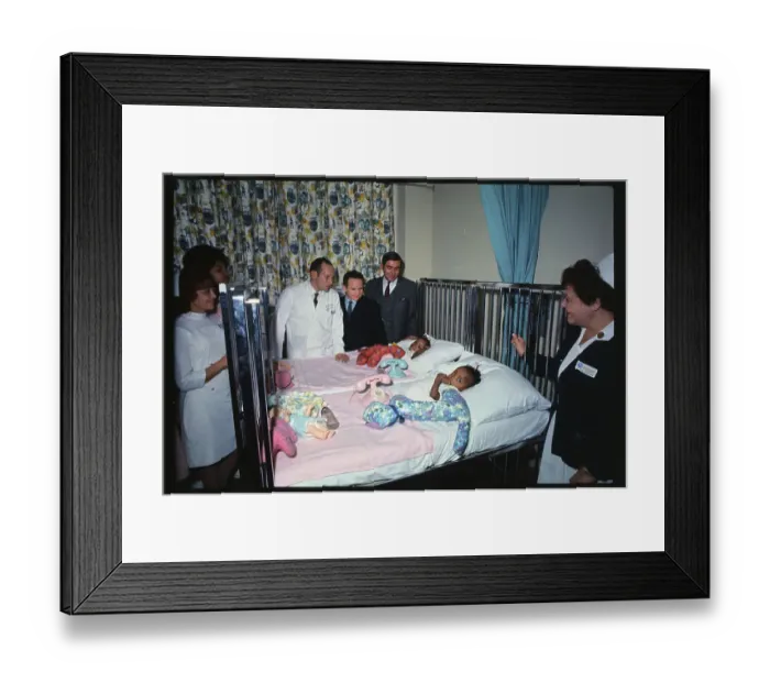 Framed Print : Successful Separation of Siamese Twins Framed Print : Successful Separation of Siamese Twins