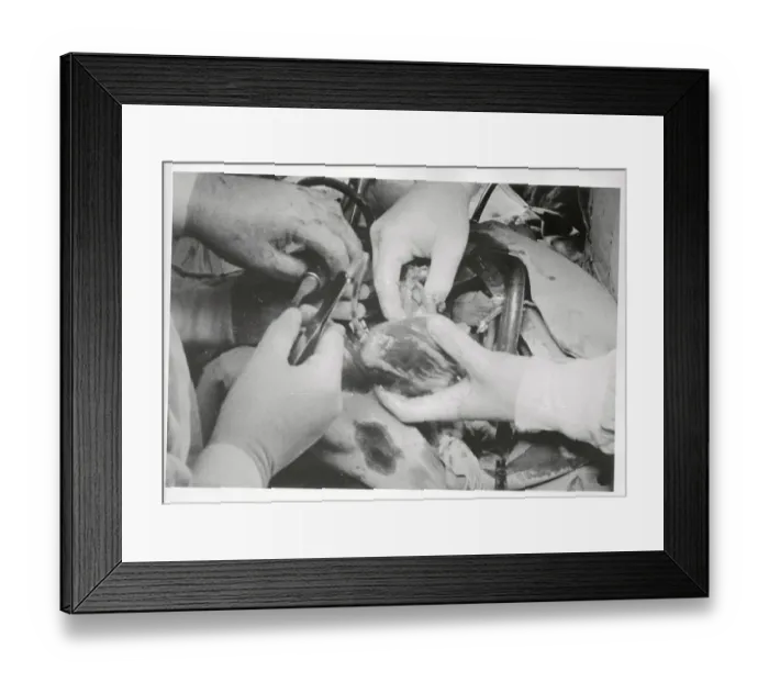 Framed Print : A Heart Transplant Operation Framed Print : A Heart Transplant Operation