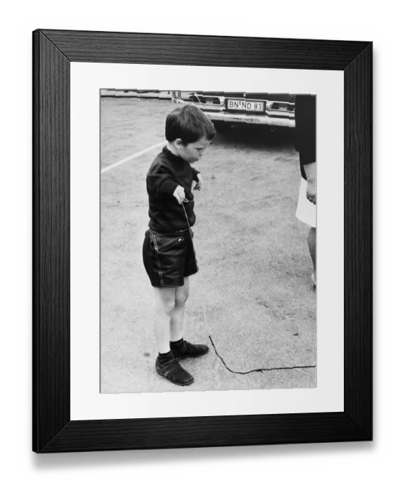 Framed Print : Child with Deformed Arms