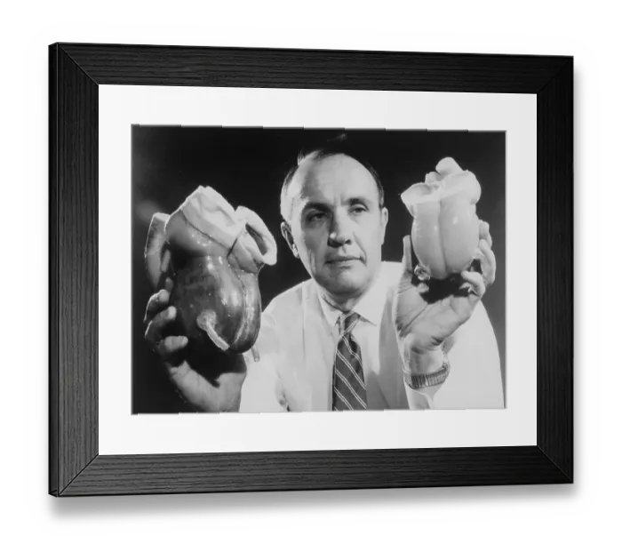 Framed Print : Man Holds Two Artificial Hearts Framed Print : Man Holds Two Artificial Hearts
