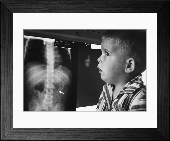 Framed Print : Brad Haines Looking at X-Ray of His Stomach Framed Print : Brad Haines Looking at X-Ray of His Stomach
