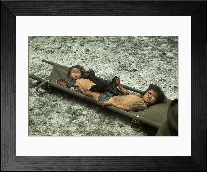 Framed Print : Wounded Vietnamese Children in Stretcher Framed Print : Wounded Vietnamese Children in Stretcher