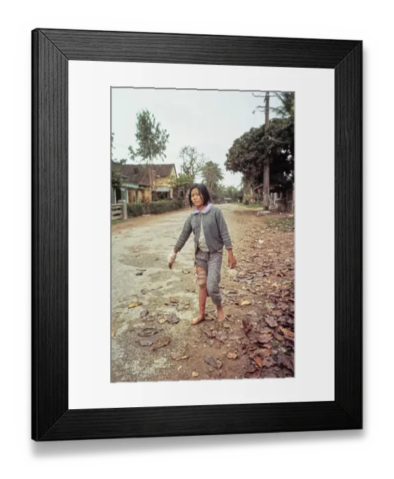 Framed Print : Injured Vietnamese, Hue Framed Print : Injured Vietnamese, Hue
