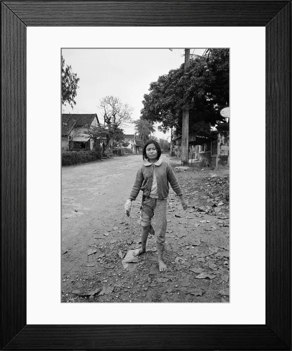 Framed Print : Young Wounded Vietnamese Girl Framed Print : Young Wounded Vietnamese Girl