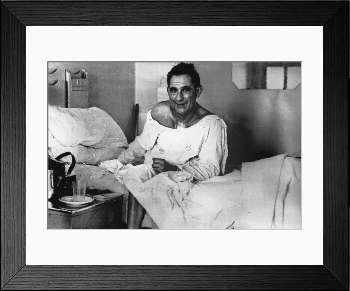 Framed Print : Heart Transplant Patient Louis Washkansky Sitting up in Bed Framed Print : Heart Transplant Patient Louis Washkansky Sitting up in Bed