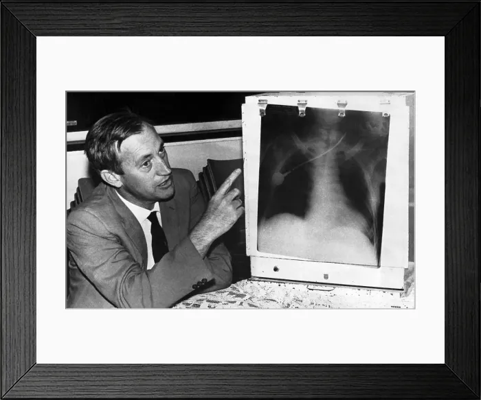 Framed Print : Surgeon Explaining First Heart Transplant Framed Print : Surgeon Explaining First Heart Transplant