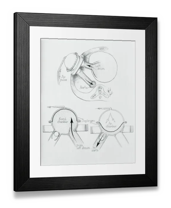 Framed Print : Diagram of Artificial Heart Compression Framed Print : Diagram of Artificial Heart Compression