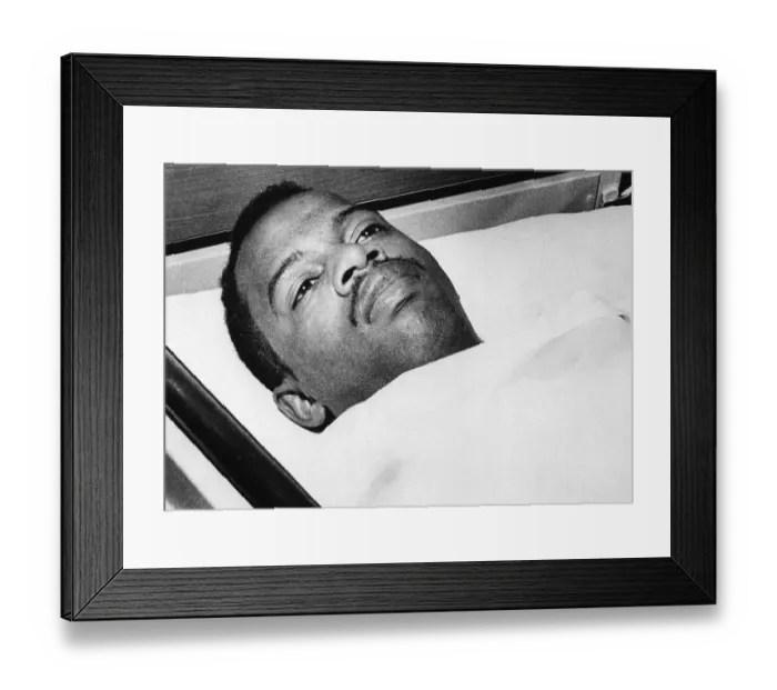 Framed Print : John Lewis In Hospital With Head Injury Framed Print : John Lewis In Hospital With Head Injury