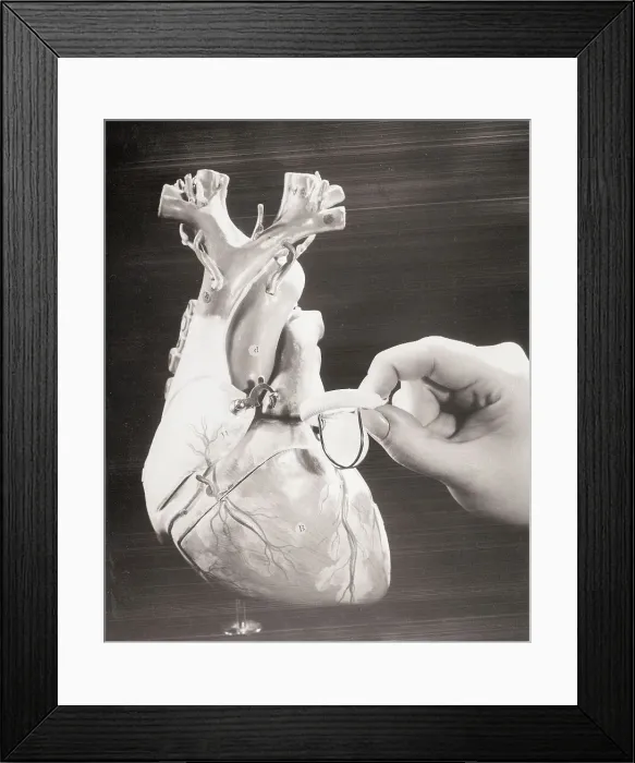 Framed Print : Close-Up of Artificial Heart Valve Framed Print : Close-Up of Artificial Heart Valve
