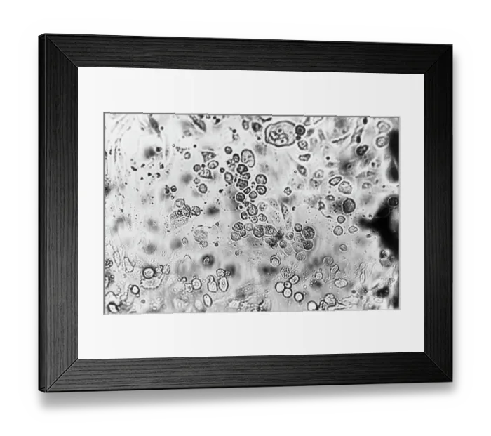 Framed Print : Microscopic View Of Virus-Infected Cell Framed Print : Microscopic View Of Virus-Infected Cell
