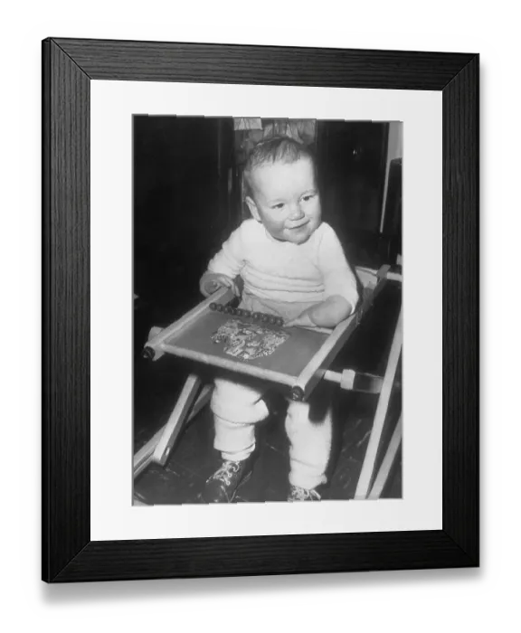 Framed Print : Malformed Baby of Thalidomide