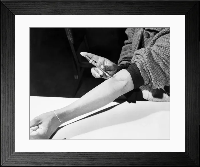 Framed Print : Veteran Drug User's Heroin Scars Framed Print : Veteran Drug User's Heroin Scars