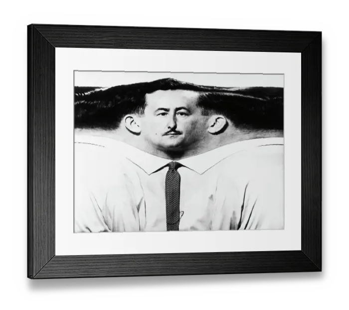 Framed Print : Flattened Periphery of Man's Head Framed Print : Flattened Periphery of Man's Head