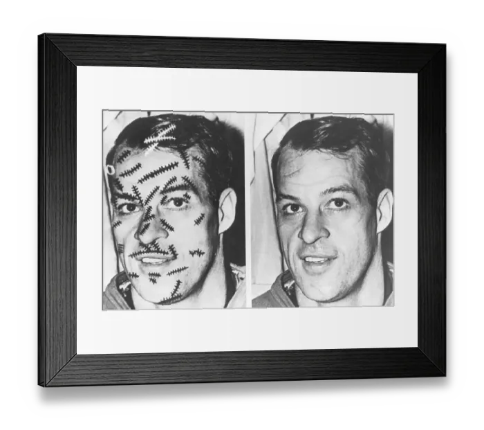 Framed Print : Gordie Howe with Stitches on Face Framed Print : Gordie Howe with Stitches on Face