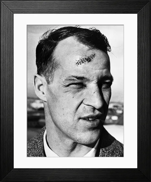 Framed Print : Gordie Howe With Stitches in Head Framed Print : Gordie Howe With Stitches in Head