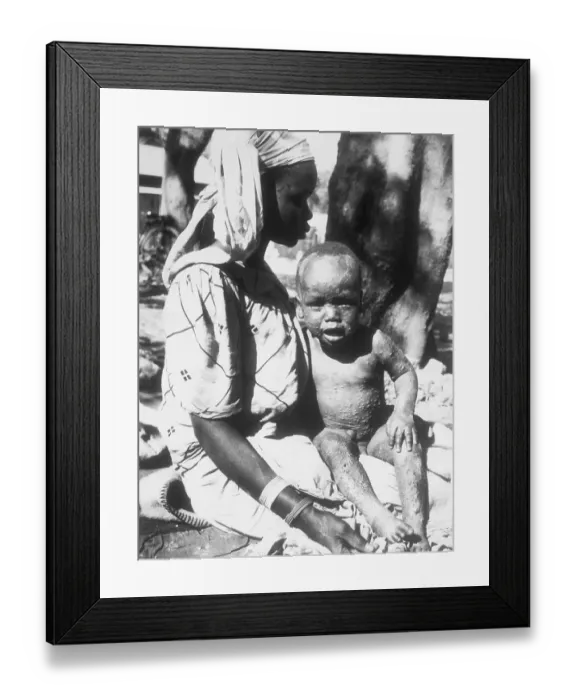 Framed Print : Stricken Baby and Mother