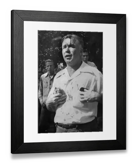Framed Print : Injured Protester in Street Framed Print : Injured Protester in Street