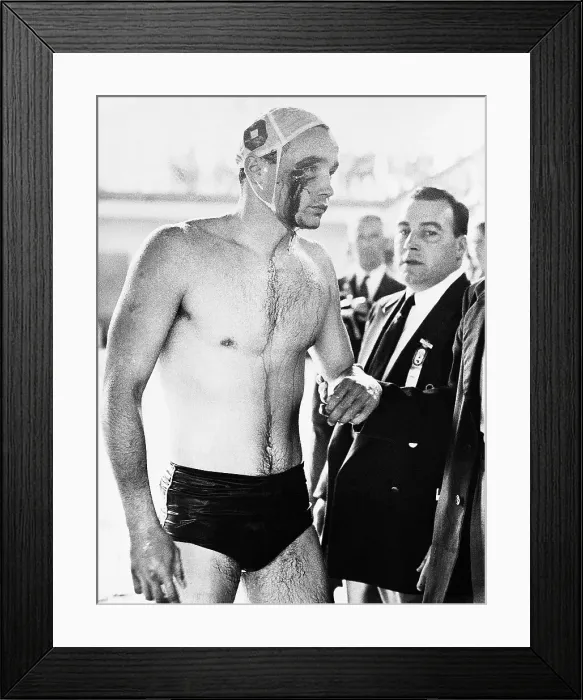 Framed Print : Water Polo Player Bleeding From Face Framed Print : Water Polo Player Bleeding From Face