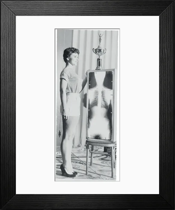Framed Print : Woman Posing Next to Skeleton X-Ray Framed Print : Woman Posing Next to Skeleton X-Ray