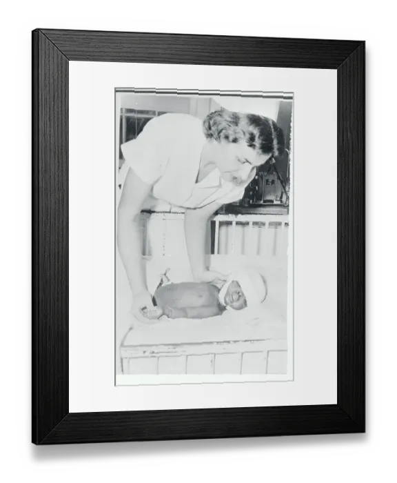 Framed Print : Siamese Twin Claudette Miller After Separation Framed Print : Siamese Twin Claudette Miller After Separation