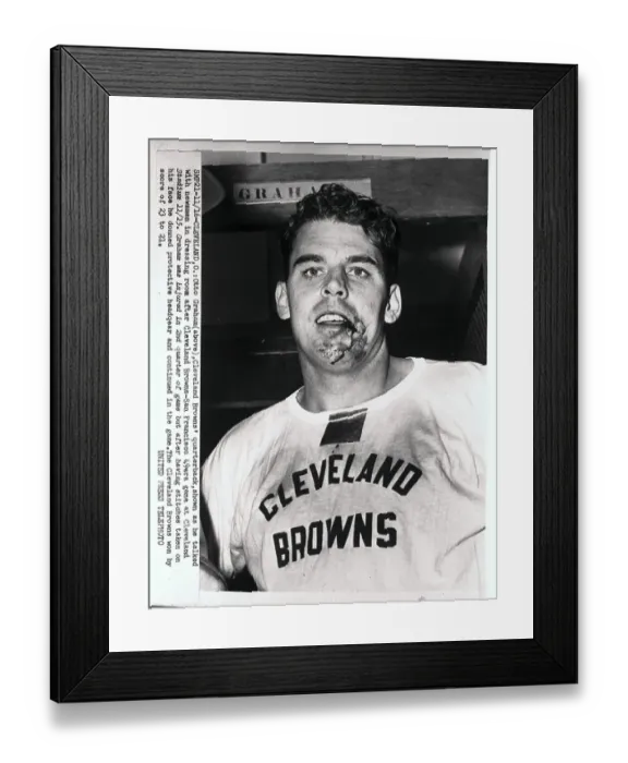 Framed Print : Otto Graham With Bloody and Injured Jaw Framed Print : Otto Graham With Bloody and Injured Jaw