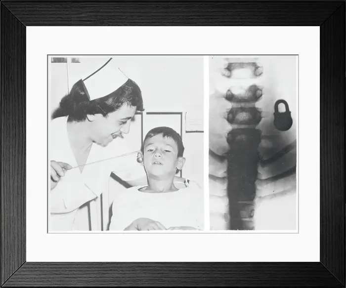 Framed Print : Nurse and X-Ray Showing Lock Framed Print : Nurse and X-Ray Showing Lock