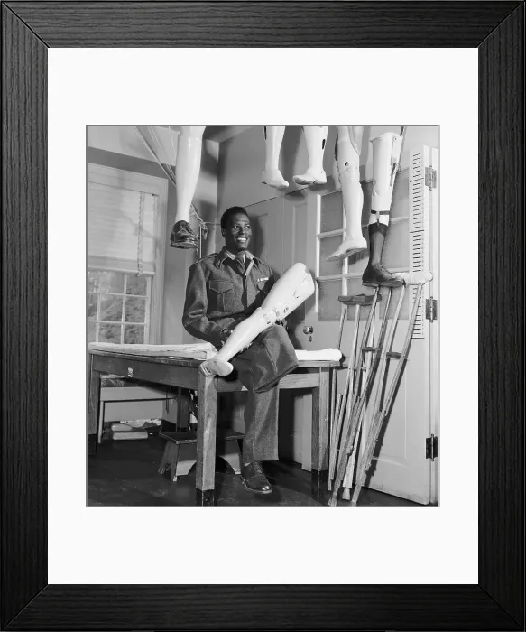 Framed Print : Ethiopian Soldier Holding Artificial Limb Framed Print : Ethiopian Soldier Holding Artificial Limb