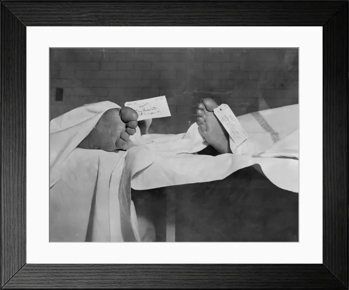 Framed Print : Toes of Tony Trombino and Tony Brancato in Morgue Framed Print : Toes of Tony Trombino and Tony Brancato in Morgue