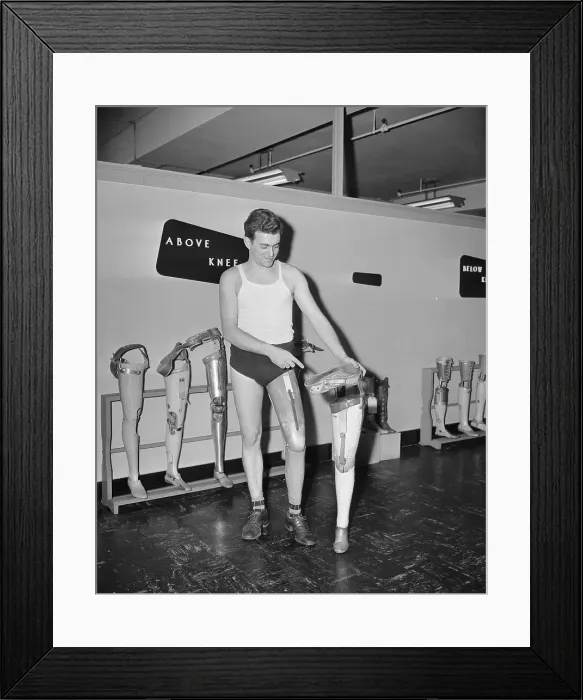 Framed Print : Robert Pollock Trying a Prosthetic Limb Framed Print : Robert Pollock Trying a Prosthetic Limb