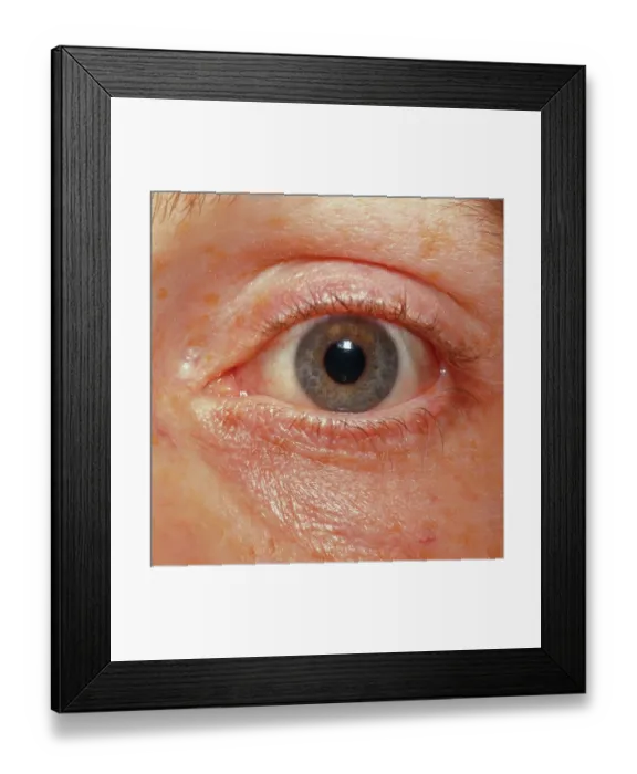Framed Print : Close Up of Human Eye with Pupil Contracting Framed Print : Close Up of Human Eye with Pupil Contracting