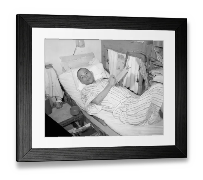 Framed Print : Victim of Radiation Disease Lying in Bed