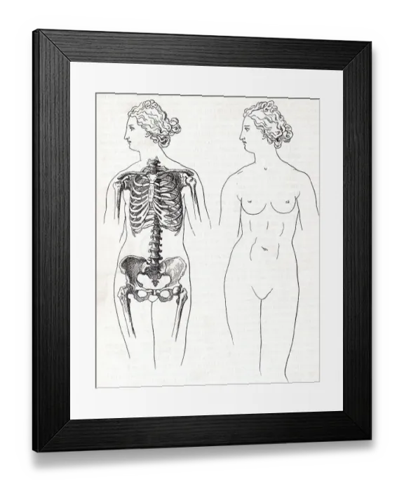 Framed Print : Illustration of Two Female Anatomies Not Influenced by Use of Corsets Framed Print : Illustration of Two Female Anatomies Not Influenced by Use of Corsets