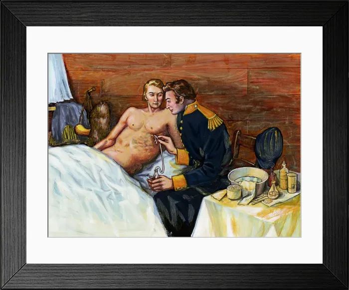 Framed Print : Illustration of Dr. William Beaumont Inserting Tube In Alexis St. Martin's Torso Framed Print : Illustration of Dr. William Beaumont Inserting Tube In Alexis St. Martin's Torso