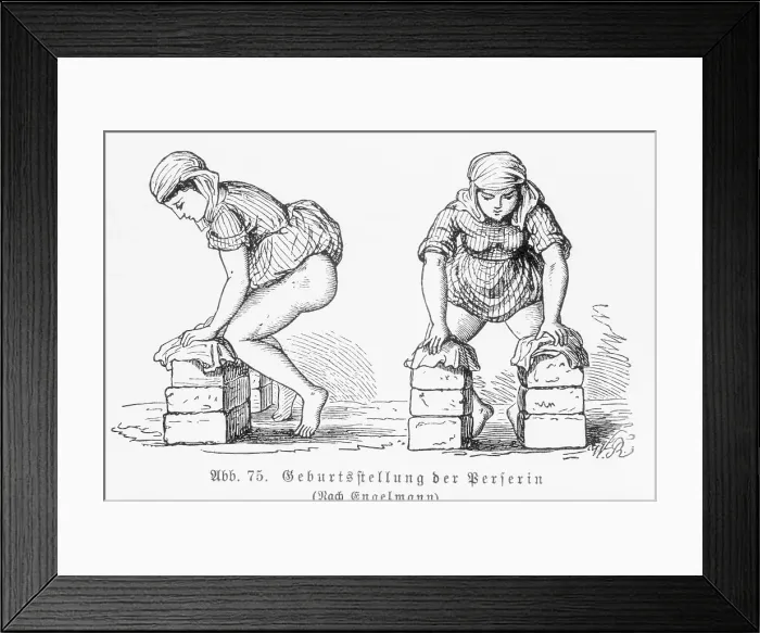 Framed Print : Illustration of a Birthing Position for Woman Framed Print : Illustration of a Birthing Position for Woman