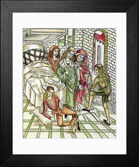 Framed Print : Medieval Illustration of Man Breaking Leg Framed Print : Medieval Illustration of Man Breaking Leg