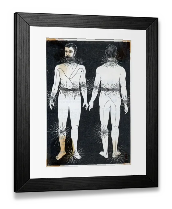 Framed Print : Electrical Belt Miracle Remedy Of 1870S Framed Print : Electrical Belt Miracle Remedy Of 1870S