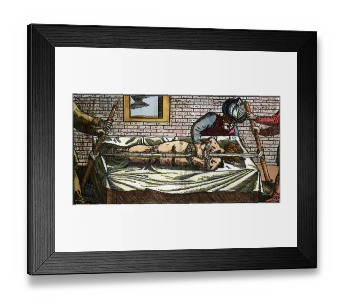 Framed Print : Illustration of Avicenna Straightening a Man's Spine Framed Print : Illustration of Avicenna Straightening a Man's Spine