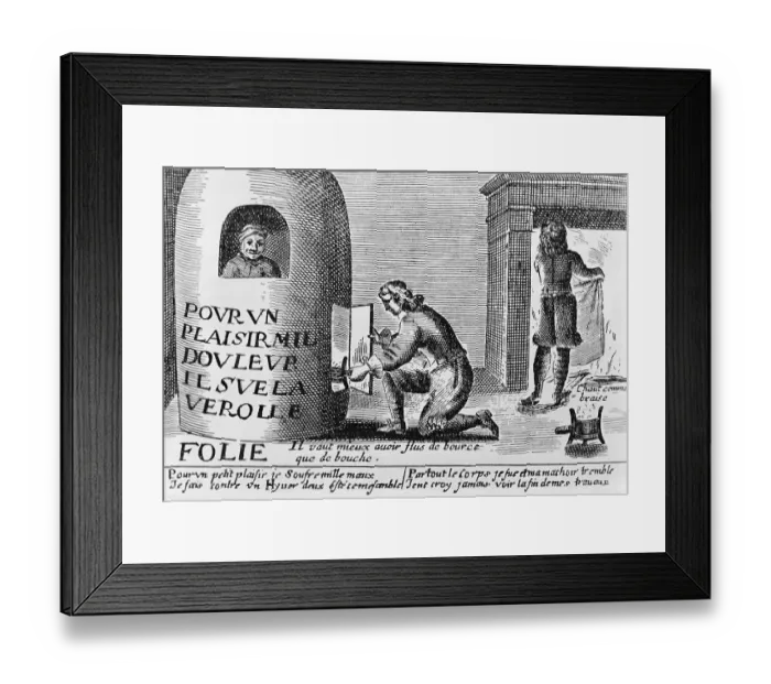 Framed Print : Illustration of a Syphilitic Man in Fumigation Stove Framed Print : Illustration of a Syphilitic Man in Fumigation Stove