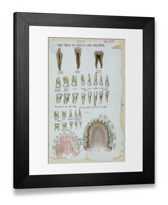 Framed Print : Teeth of Adults and Children Framed Print : Teeth of Adults and Children