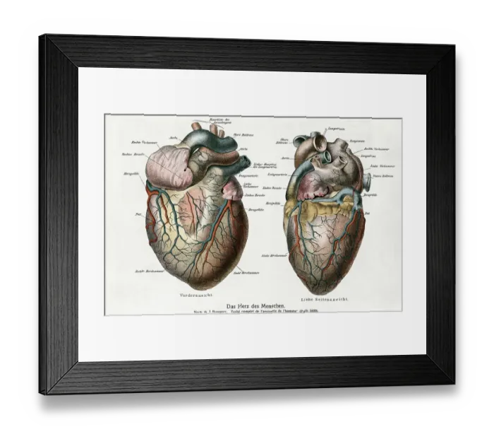 Framed Print : Two Diagrams of the Human Heart Framed Print : Two Diagrams of the Human Heart