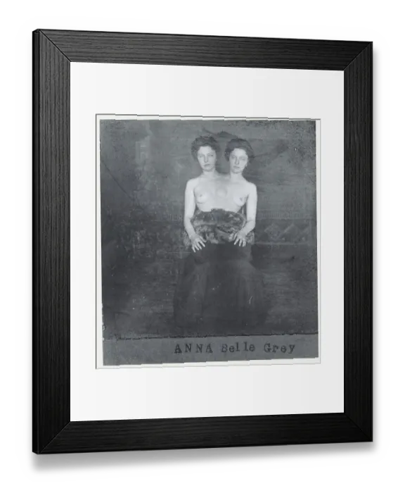 Framed Print : Portrait of Siamese Twins Framed Print : Portrait of Siamese Twins