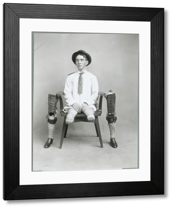 Framed Print : Portrait of a Legless Man Framed Print : Portrait of a Legless Man