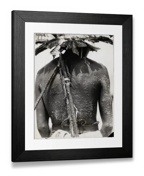 Framed Print : Man From San Blas W / Scarring On Back Framed Print : Man From San Blas W / Scarring On Back