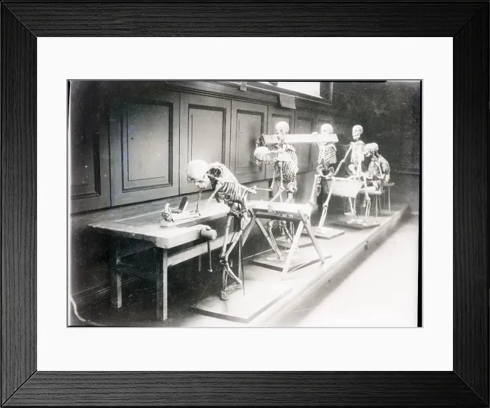 Framed Print : Skeletons Posed As If Laboring Framed Print : Skeletons Posed As If Laboring