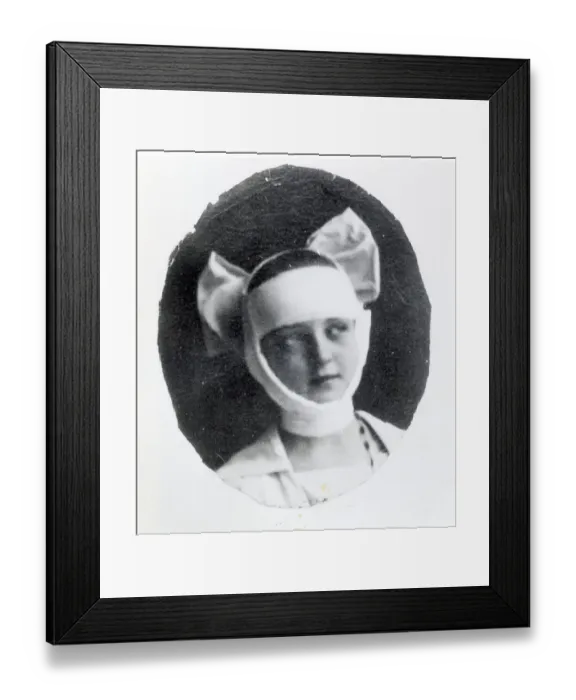 Framed Print : Bette Davis W / Face Wrapped In Bandage Framed Print : Bette Davis W / Face Wrapped In Bandage