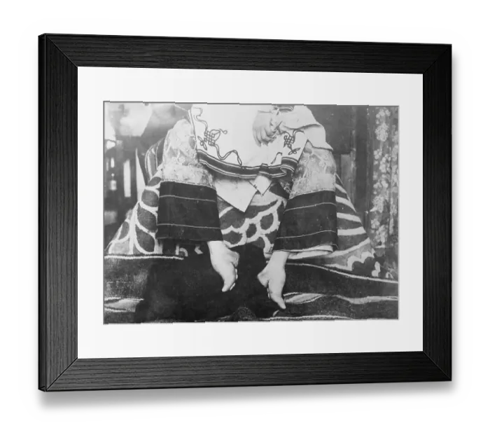 Framed Print : Portrait of Chinese Foot Binding Framed Print : Portrait of Chinese Foot Binding