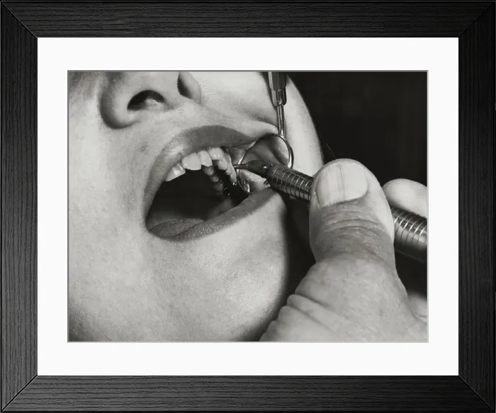 Framed Print : Dentist Drilling Inside a Mouth Framed Print : Dentist Drilling Inside a Mouth