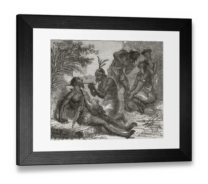 Framed Print : Couple Getting Teeth Filed Framed Print : Couple Getting Teeth Filed