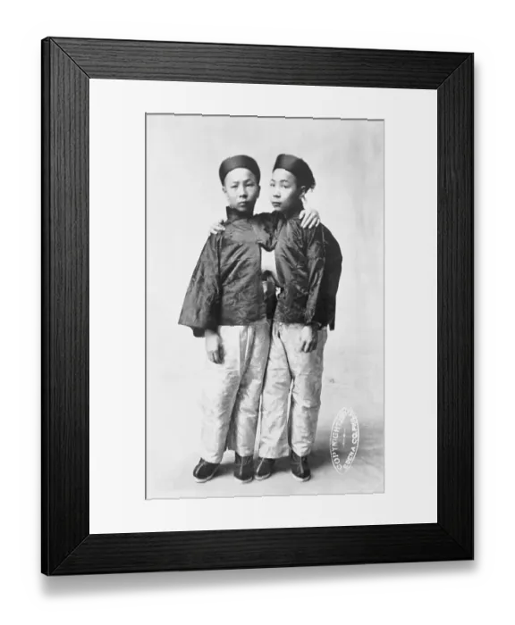 Framed Print : Portrait of Siamese Twins Framed Print : Portrait of Siamese Twins