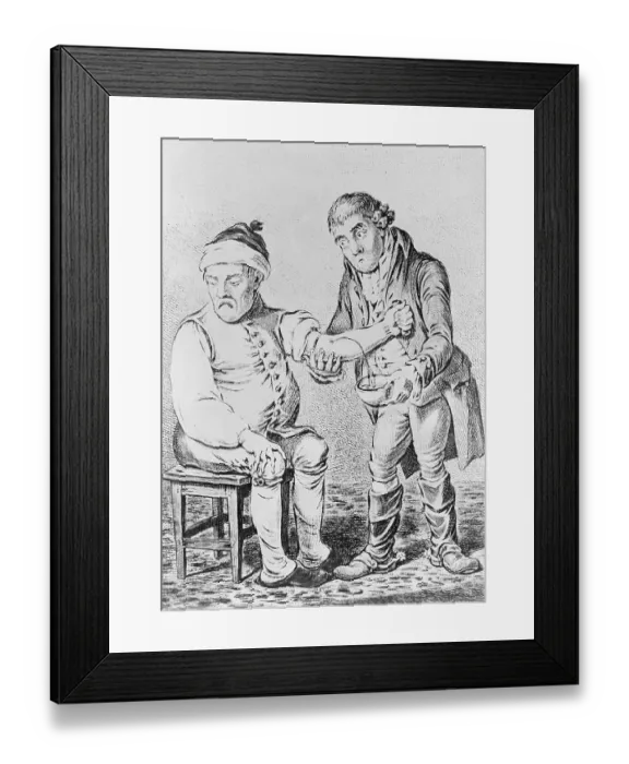 Framed Print : Early Physician Bloodletting a Patient Framed Print : Early Physician Bloodletting a Patient